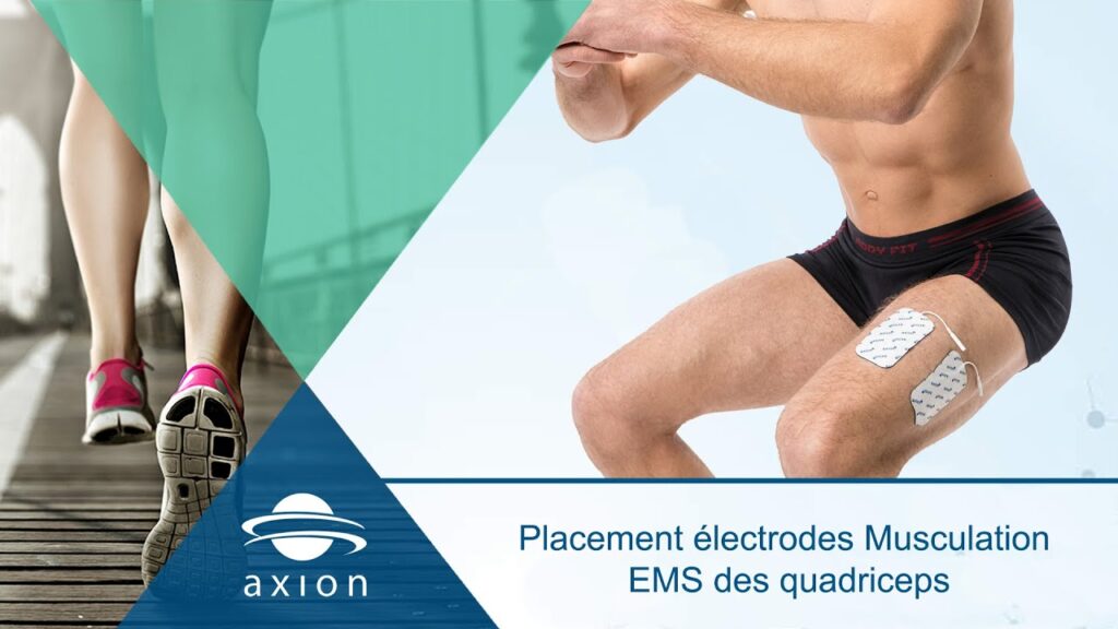Maîtriser l’art du placement des électrodes pour optimiser l’EMS des quadriceps : un guide essentiel pour les passionnés de musculation