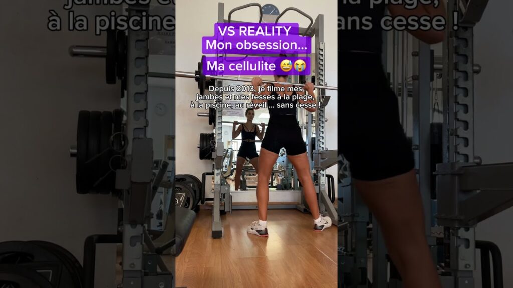 Cellulite : décryptage d’un complexe et solutions concrètes pour l’accepter